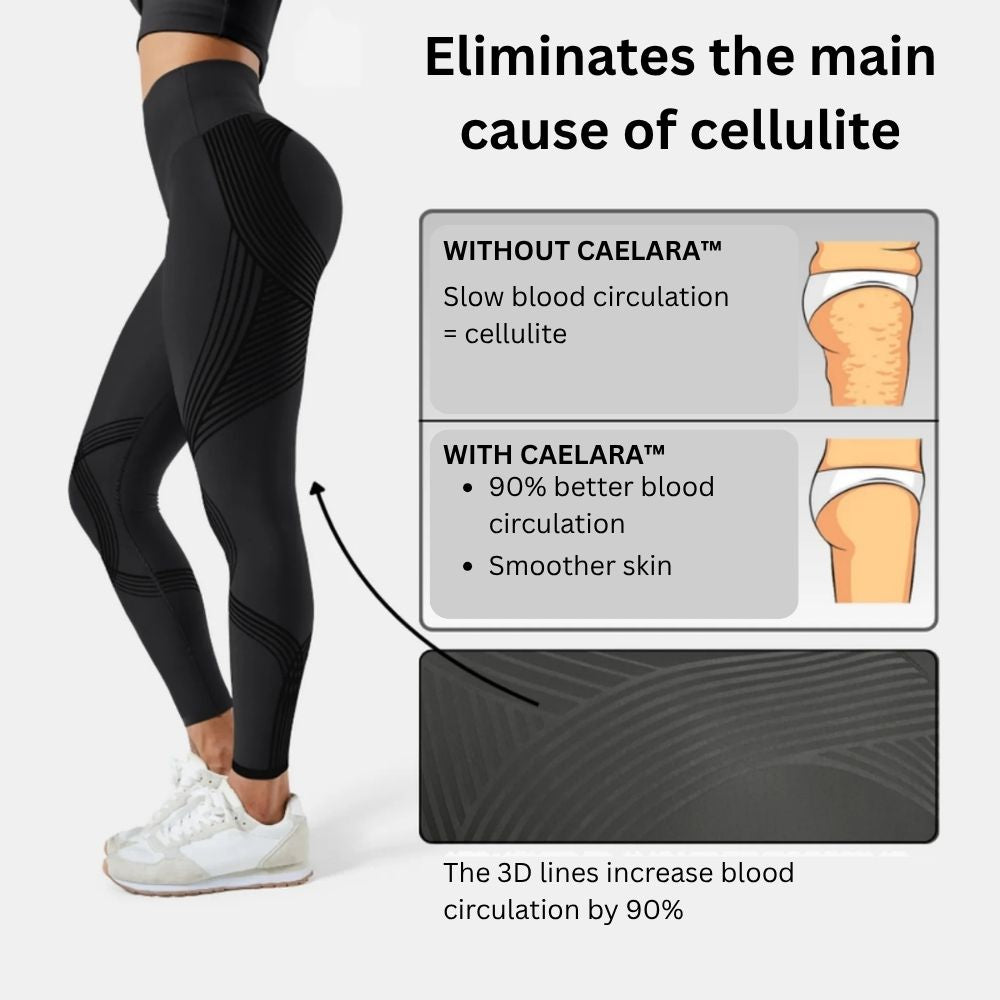 SILVESSA ™ - ANTI-CELLULITE SCULPTING COMPRESSION LEGGINGS
