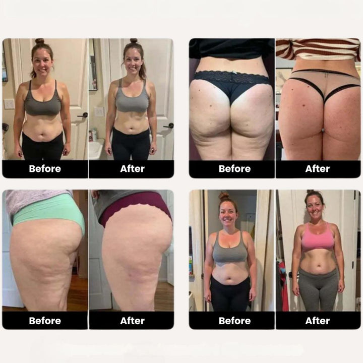 SILVESSA ™ - ANTI-CELLULITE SCULPTING COMPRESSION LEGGINGS